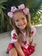Medium Stripe Print Sequin Hair Bow